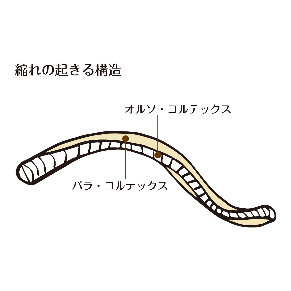 縮れの起きる構造